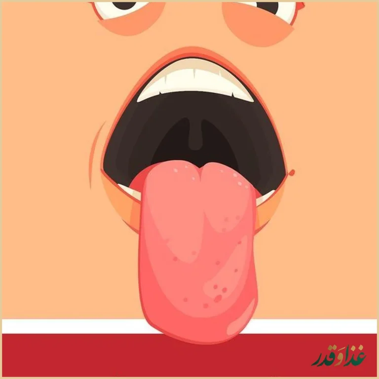 رستوران پرسه